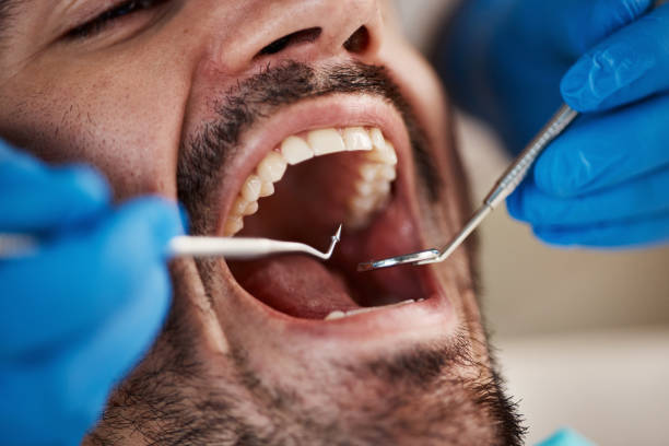 Best Urgent Tooth Repair  in Melbourne, FL