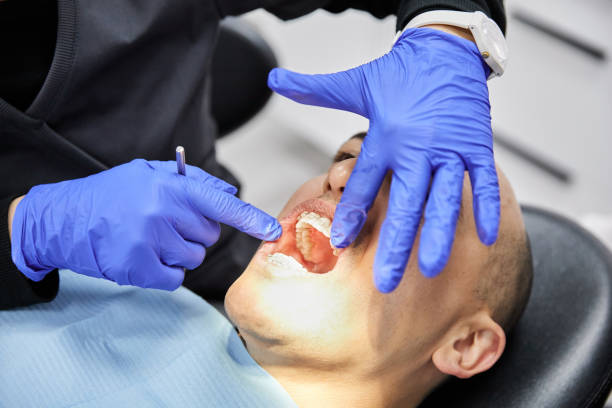 Best Knocked-Out Tooth Emergency  in Melbourne, FL